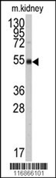 ALDH9A1 Antibody (N-term)