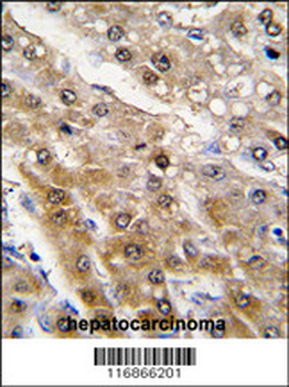 ALDH9A1 Antibody (N-term)