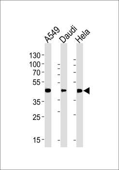 ALDH3A1 Antibody (Center)