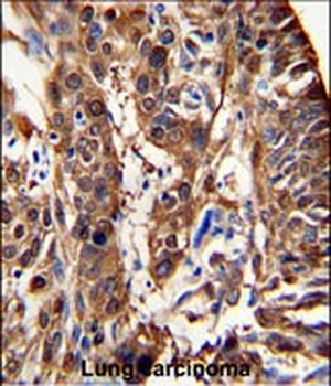 ALDH3A1 Antibody (N-term)