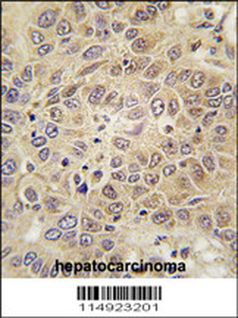 MARS Antibody (C-term)