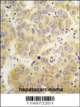 VARS Antibody (N-term)