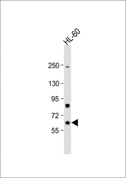 Methionyl tRNA Synthetase Antibody (C-term)
