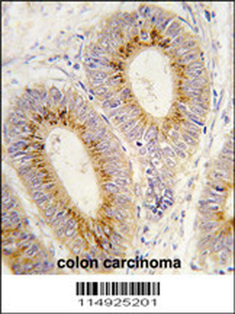 Methionyl tRNA Synthetase Antibody (C-term)
