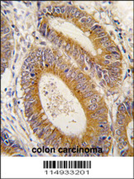 YARS2 Antibody (N-term)