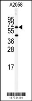 BCHE Antibody (Center)