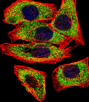 Transglutaminase (TGM2) Antibody (Center K444)