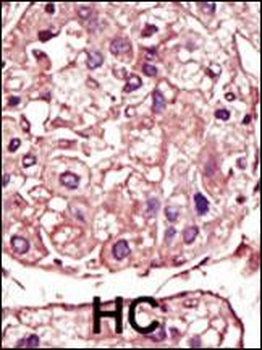 TGF Beta Receptor I Antibody (Center)