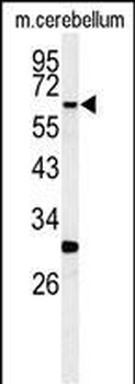 RIPK3 Antibody (C-term)