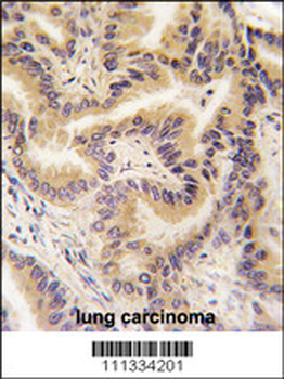 RAF1 Antibody (S233)