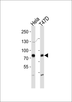 BRAF Antibody
