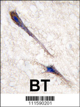 RAF1 (BRAF) Antibody (T598)