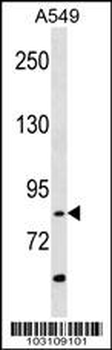 RIPK4 (ANKRD3) Antibody (C-term)