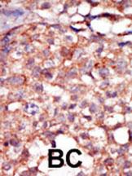 RIPK4 (ANKRD3) Antibody (C-term)