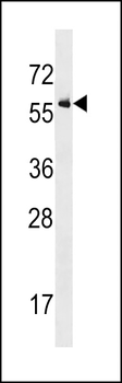 Activin Receptor Type IA (ACVR1) Antibody (Center R147)