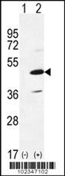 IRAK4 Antibody (N-term)