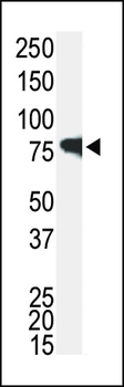 IRAK Antibody (C-term)