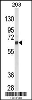 CYP3A5 Antibody (Center)