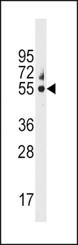 CYP3A5 Antibody (C-term)