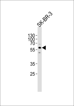 CYP3A5 Antibody (C-term)