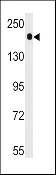 ACE Antibody (C-term)