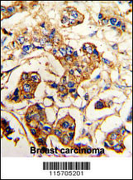 ACTN4 Antibody (C-term)