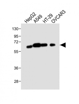 CYP3A4 Antibody (Center)