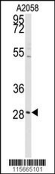 PRKCDBP Antibody (Center)