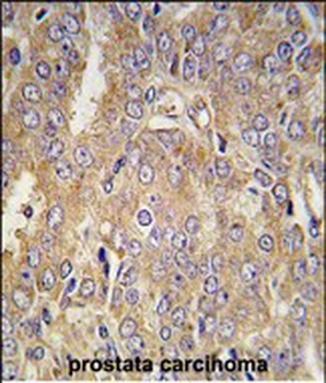 LTBP1 Antibody (C-term)