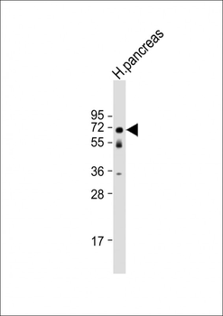 BACE1 Antibody (N-term)