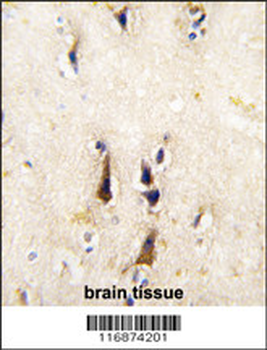 BACE1 Antibody (N-term)