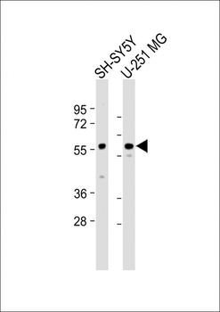 BACE Antibody (S498)