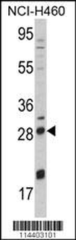 NGFB Antibody (Center)