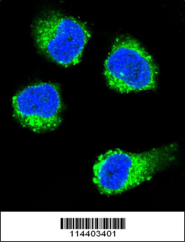 NGFB Antibody (Center)