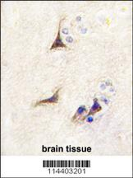 NGFB Antibody (Center)
