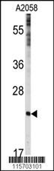 CAV1 Antibody (N-term)