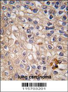CAV1 Antibody (N-term)
