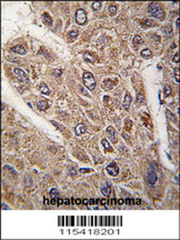 BICD2 Antibody (C-term)