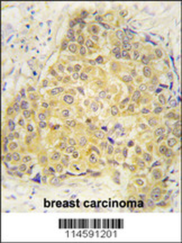 SEMA3A Antibody (Center)