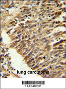 HIF1Alpha Antibody (Center)