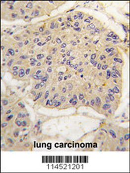 FKBP12 Antibody (Center)