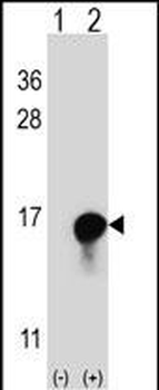 FKBP1A Antibody (C-term)