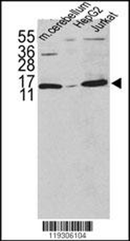FKBP1A Antibody (N-term)