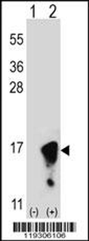 FKBP1A Antibody (N-term)