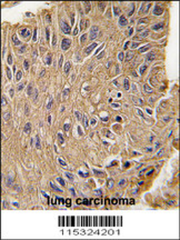ANTXR1 Antibody (Y382)