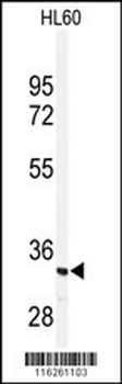 PRKRA Antibody (S246)