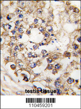 PDX1 Antibody (N-term)