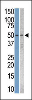 STK38L Antibody (C-term)