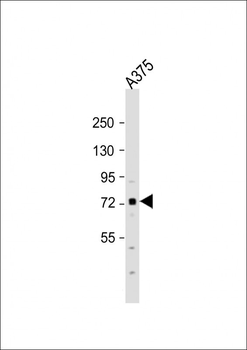 SRPK1 Antibody (C-term)