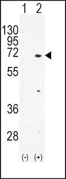 TXK Antibody (N-term)